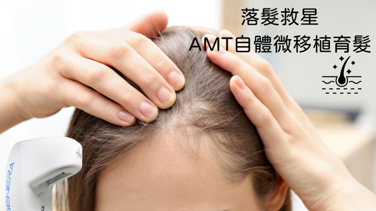 RA-自體微移植育髮