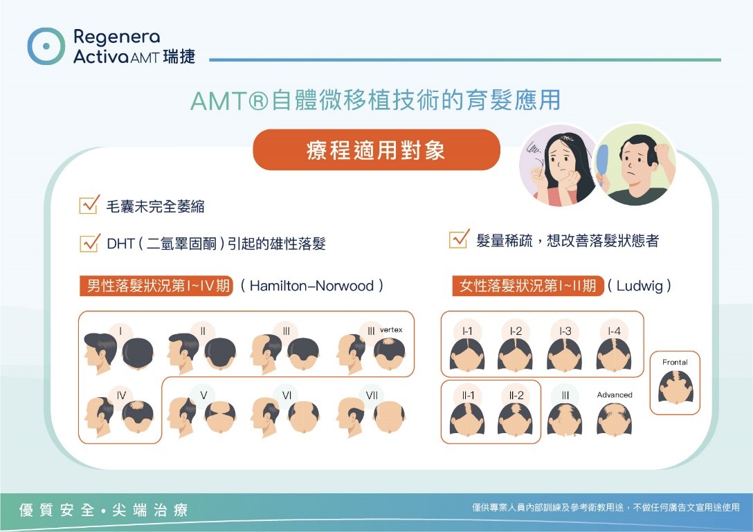 RA-自體微移植育髮