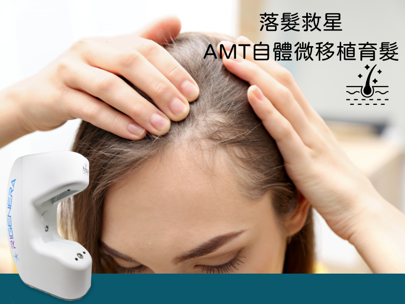 RA-自體微移植育髮