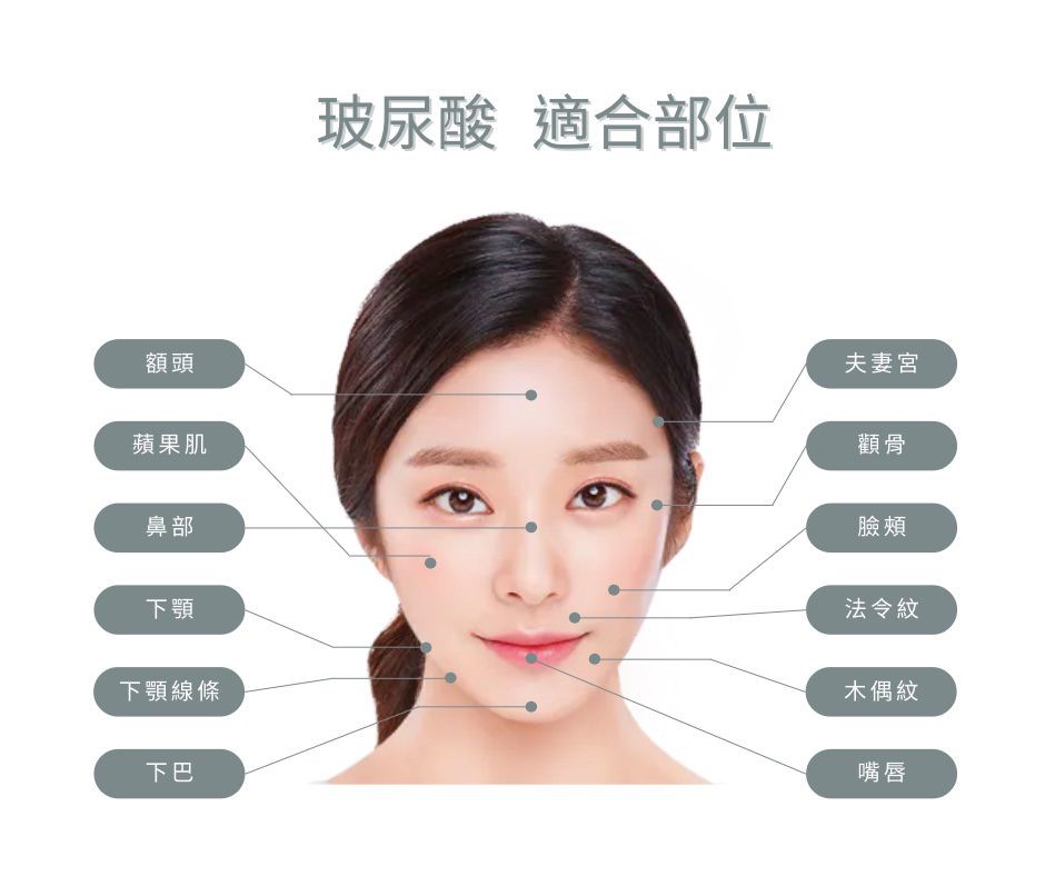 玻尿酸全臉雕塑